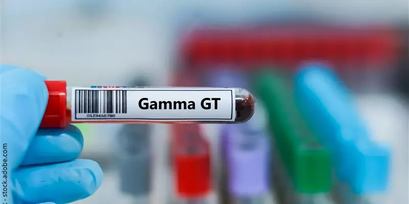 Blutprobe zur Gamma GT Wert Prüfung