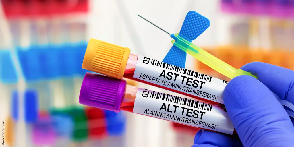 Blutprobe zum AST und ALT Test