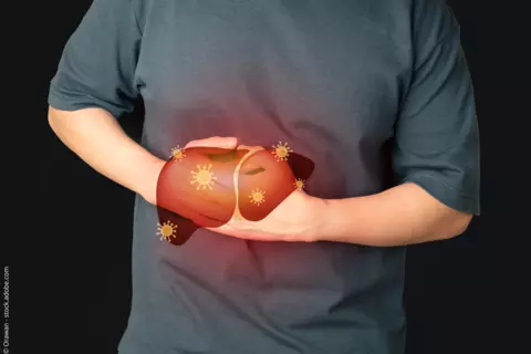 Person fasst sich an Bauch