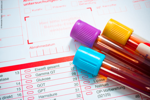 Drei Blutprobenröhrchen auf Formular