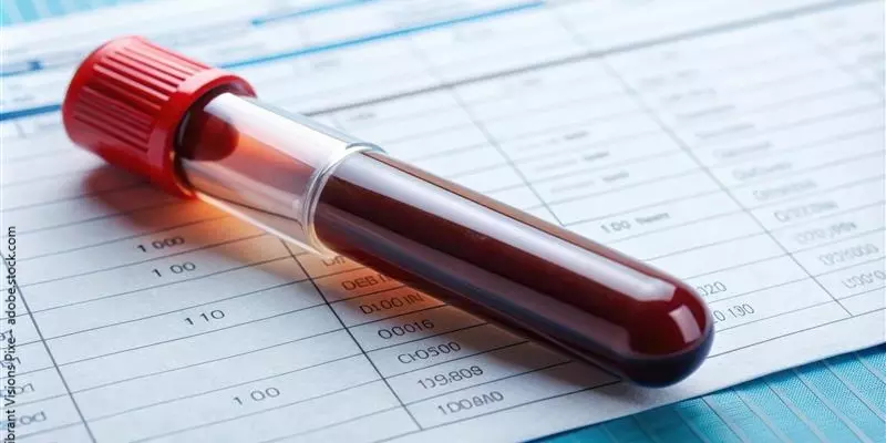 Gefülltes Blutentnahmeröhrchen liegt auf Formularausdruck für Blutwerte