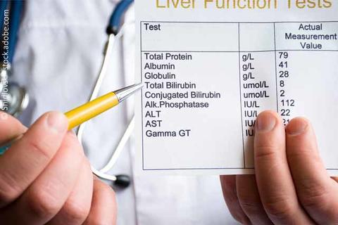 Arzt mit Auswertung von Laborwerten