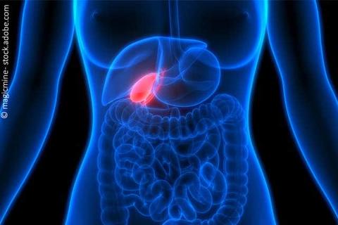 Grafische Darstellung einer Gallenblase