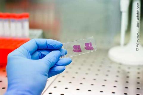 Hand mit Leberprobe im Labor