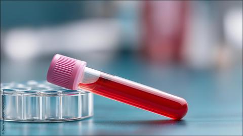 Gefüllte Blutprobe an eine Petrischale gelehnt