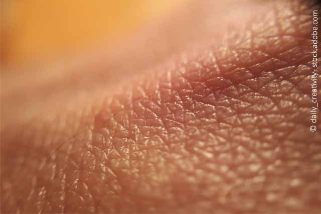 Wie Verändert Sich Die Haut Bei Einer Kranken Leber?